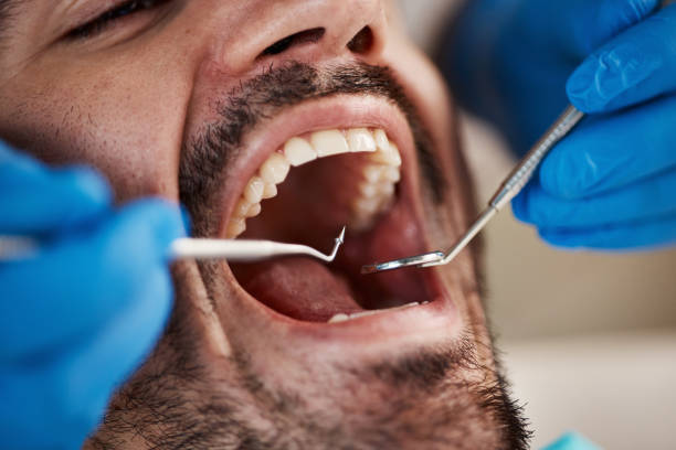Best Emergency Dental Services for Seniors in South Highpoint, FL