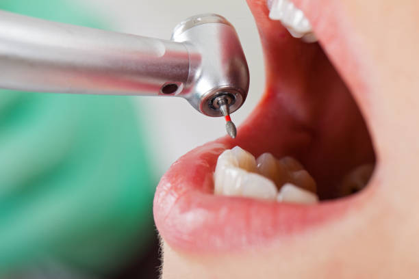 Best Emergency Cosmetic Dentistry in South Highpoint, FL